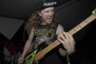 VULVODYNIA